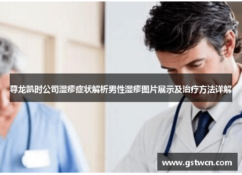 尊龙凯时公司湿疹症状解析男性湿疹图片展示及治疗方法详解